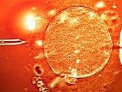 在东莞做试管婴儿大概要多少钱？2026试管费用详细